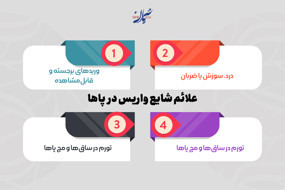 علائم شایع واریس در پاها