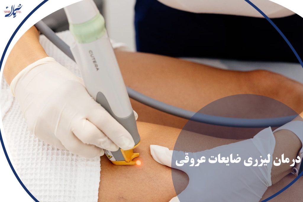 درمان لیزری ضایعات عروقی