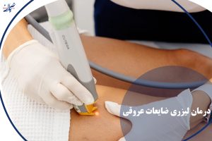 درمان لیزری ضایعات عروقی