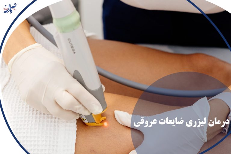 درمان لیزری ضایعات عروقی