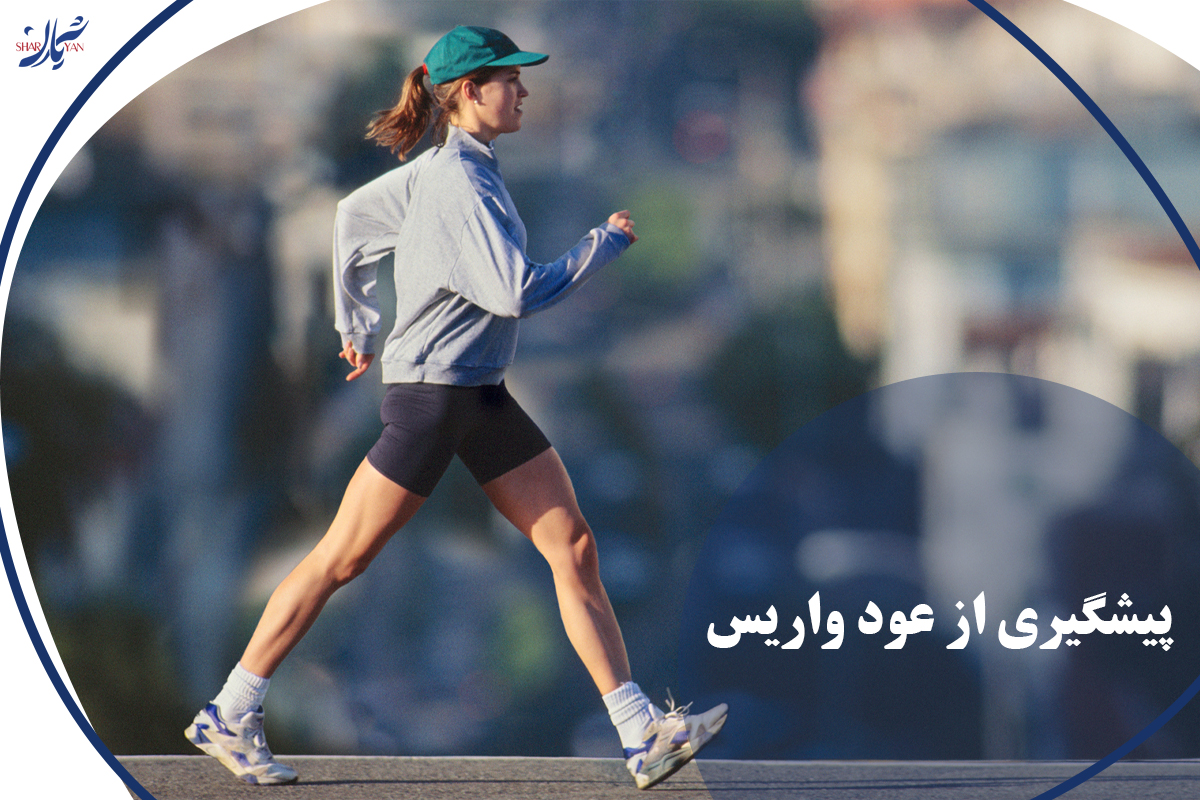 پیشگیری از عود واریس 