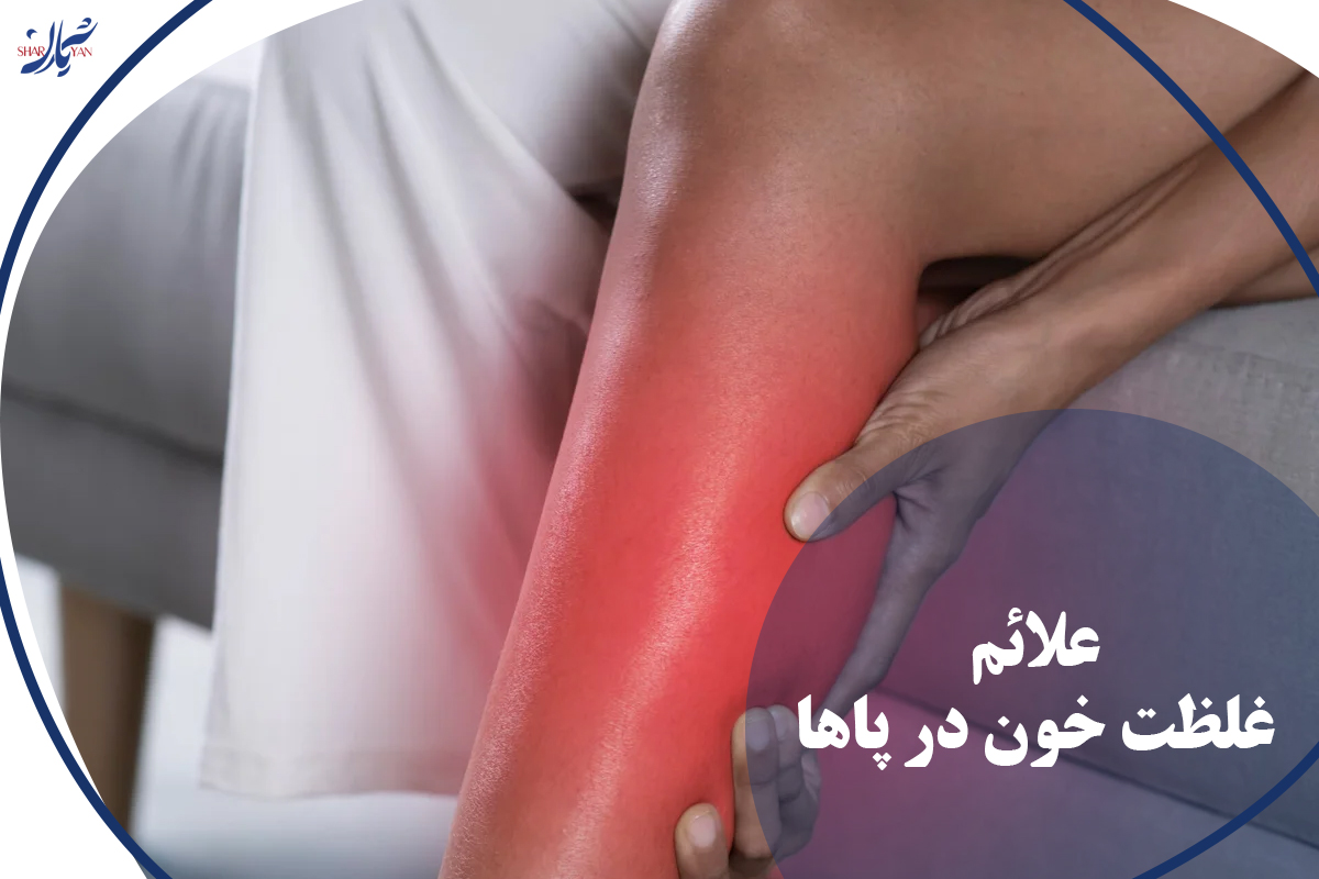 غلظت خون در پاها