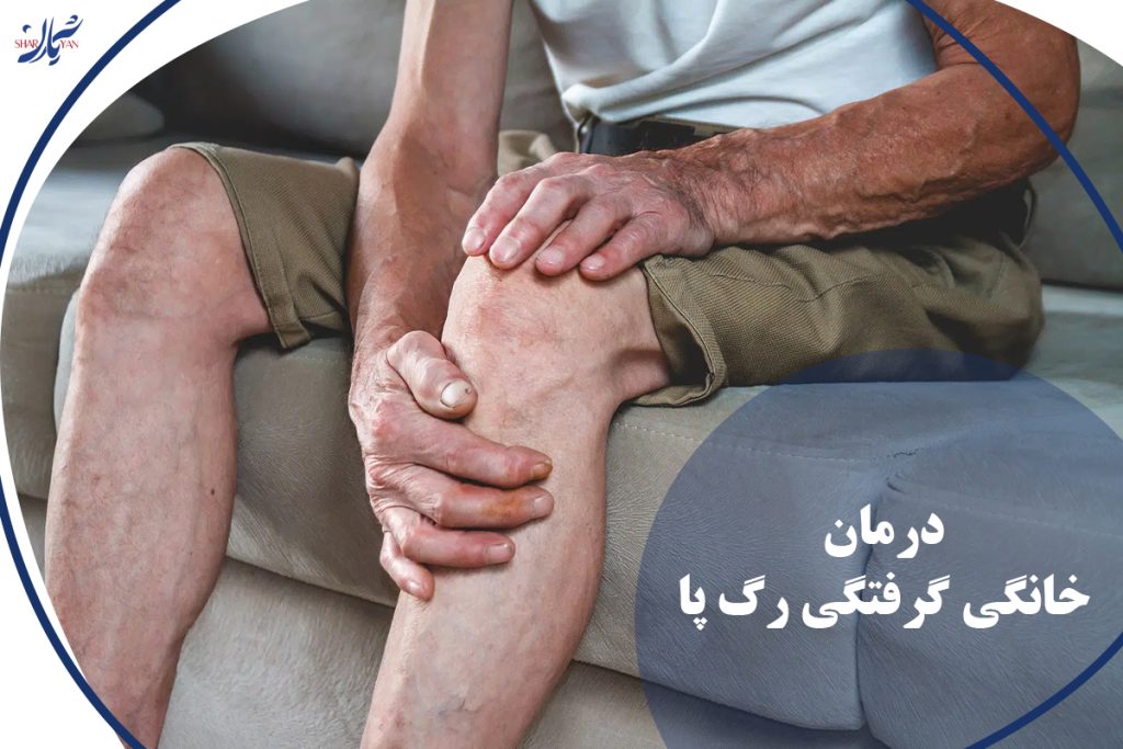 گرفتگی رگ پا